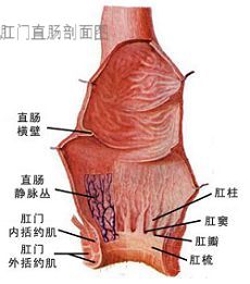 内痔